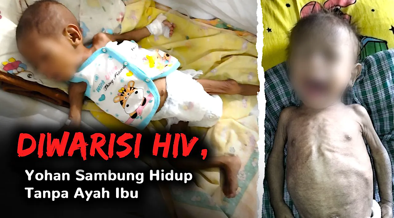 Ortu Meninggal Krn HIV, Yohan Warisi Virus yg Sama